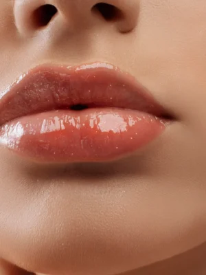 cherry2
