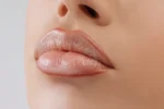 Marilyn